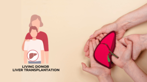 living-donor-liver-transplant