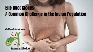 Stones in bile duct_ Incidence in the Indian population_20240521_194728_0000