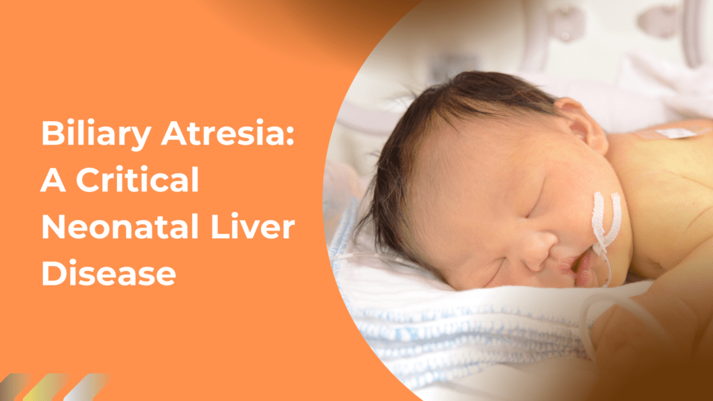 Biliary-Atresia